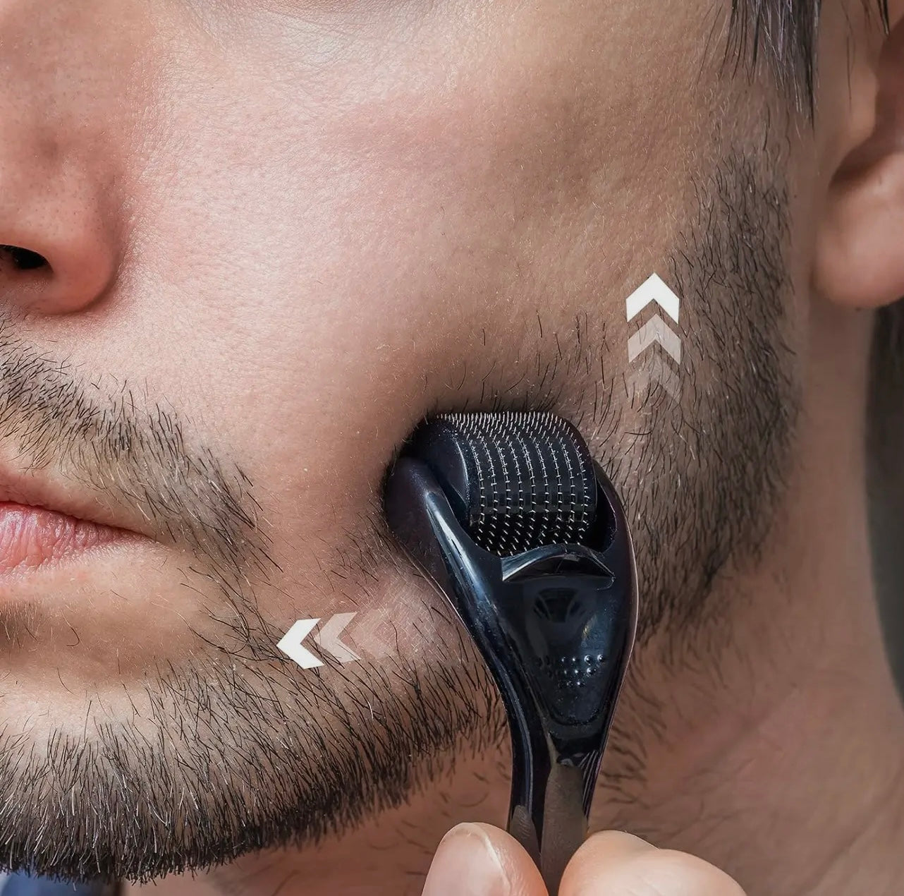 Micro Needle Derma Roller .25 Scalp & Beard